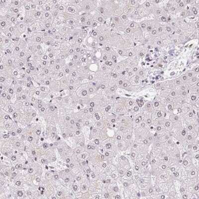Immunohistochemistry-Paraffin TCERG1 Antibody - BSA Free