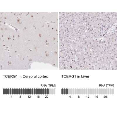 <b>Orthogonal Strategies Validation. </b>Immunohistochemistry-Paraffin: TCERG1 Antibody [NBP2-39037] - Staining in human cerebral cortex and liver tissues using anti-TCERG1 antibody. Corresponding TCERG1 RNA-seq data are presented for the same tissues.