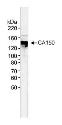 Western Blot: TCERG1 Antibody [NB300-214] - Nuclear extract (5 ug) from HeLa cells. Antibody used at 0.33 ug/ml. Detection: Alkaline phosphatase conjugated goat anti-Rabbit IgG diluted 1:3,000 with NBT-BCIP as substrate for 20 min.