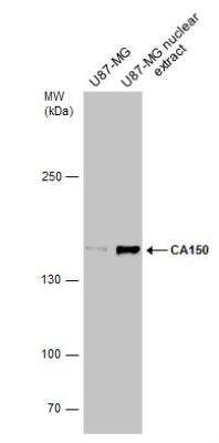 Western Blot: TCERG1 Antibody [NBP2-20584] - U87-MG whole cell and nuclear extracts (30 ug) were separated by 5% SDS-PAGE, and the membrane was blotted with CA150 antibody diluted at 1:500.