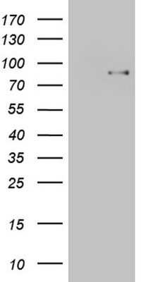 Western Blot: TCF-12/HTF4 Antibody (OTI4D6) - Azide and BSA Free [NBP2-74473] - Analysis of HEK293T cells were transfected with the pCMV6-ENTRY control (Left lane) or pCMV6-ENTRY TCF12.