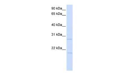 Western Blot: TCF21 Antibody [NBP2-83633] - WB Suggested Anti-TCF21 Antibody Titration: 0.2-1 ug/ml. ELISA Titer: 1:312500. Positive Control: Transfected 293T