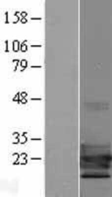 Western Blot: TCF21 Overexpression Lysate (Adult Normal) [NBP2-04729] Left-Empty vector transfected control cell lysate (HEK293 cell lysate); Right -Over-expression Lysate for TCF21.