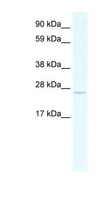Western Blot: TCF23 Antibody [NBP1-91533] - SP2/0 cell lysate, concentration 2.5 ug/ml.