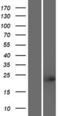 Western Blot: TCF23 Overexpression Lysate (Adult Normal) [NBP2-05050] Left-Empty vector transfected control cell lysate (HEK293 cell lysate); Right -Over-expression Lysate for TCF23.