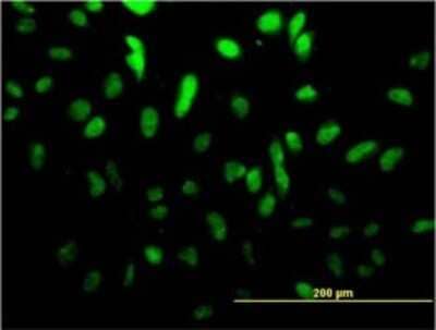 Immunocytochemistry/Immunofluorescence: TCF4 Antibody (3E10) [H00006925-M01] - Analysis of monoclonal antibody to TCF4 on HeLa cell. Antibody concentration 10 ug/ml.