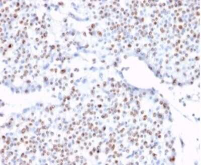 Immunohistochemistry-Paraffin: TCF4 Antibody (TCF4/1705) - Azide and BSA Free [NBP3-08236] - Formalin-fixed, paraffin-embedded human bladder stained with TCF4 Antibody (TCF4/1705) at 2ug/ml. HIER: Tris/EDTA, pH9.0, 45min. HRP-polymer, 30min. DAB, 5min.