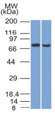 Western Blot TCF4 Antibody (TCF4/1705)