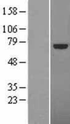 Western Blot TCF4 Overexpression Lysate