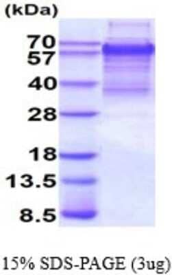 SDS-Page: Recombinant Human TCF4 Protein [NBP2-51618] - 15% SDS Page (3 ug)