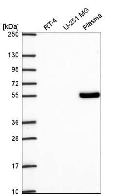 Western Blot: TCF7/TCF1 Antibody [NBP2-57570] - Western blot analysis in human cell line RT-4, human cell line U-251 MG and human plasma.