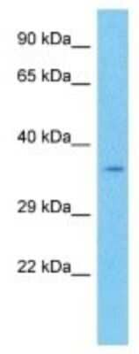 Western Blot: TCF7/TCF1 Antibody [NBP3-10110] - Western blot analysis of TCF7/TCF1 in Mouse Small Intestine lysates. Antibody dilution at 1ug/ml