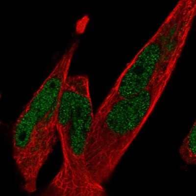 Immunocytochemistry/Immunofluorescence: TCF7L1/TCF3 Antibody [NBP2-56055] - Staining of human cell line RH-30 shows localization to nucleoplasm. Antibody staining is shown in green.