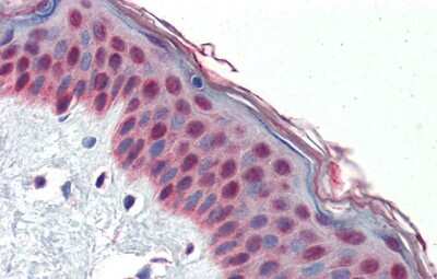 Immunohistochemistry: TCF7L1/TCF3 Antibody [NBP3-10886] - Immunohistochemical analysis of human skin lysate tissue at an antibody concentration of 5.0ug/ml