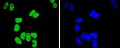 Immunocytochemistry/Immunofluorescence: TCF7L2 Antibody (SC06-90) [NBP2-67618] - Staining TCF7L2 in Hela cells (green). The nuclear counter stain is DAPI (blue). Cells were fixed in paraformaldehyde, permeabilised with 0.25% Triton X100/PBS.