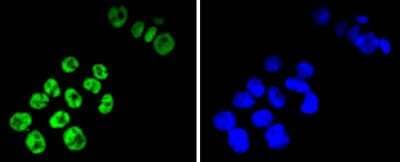 Immunocytochemistry/Immunofluorescence: TCF7L2 Antibody (SC06-90) [NBP2-67618] - Staining TCF7L2 in SW480 cells (green). The nuclear counter stain is DAPI (blue). Cells were fixed in paraformaldehyde, permeabilised with 0.25% Triton X100/PBS.