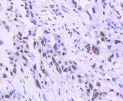 Immunohistochemistry-Paraffin: TCF7L2 Antibody (SC06-90) [NBP2-67618] - Analysis of paraffin-embedded human kidney tissue using anti-TCF7L2 antibody. Counter stained with hematoxylin.