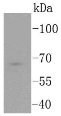 Western Blot: TCF7L2 Antibody (SC06-90) [NBP2-67618] - Analysis of TCF7L2 on Jurkat cells lysates using anti-TCF7L2 antibody at 1/1,000 dilution.