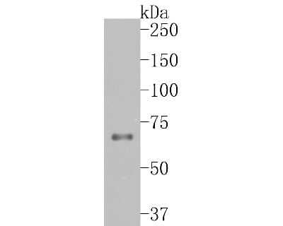 Western Blot: TCF7L2 Antibody (SC06-90) [NBP2-67618] - Western blot analysis of TCF7L2 on JAR cell lysates. Proteins were transferred to a PVDF membrane and blocked with 5% BSA in PBS for 1 hour at room temperature. The primary antibody (1/500) was used in 5% BSA at room temperature for 2 hours. Goat Anti-Rab