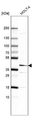 Western Blot: TCFL5 Antibody [NBP2-49174] - Analysis in human cell line MOLT-4.