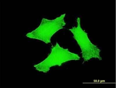 Immunocytochemistry/Immunofluorescence: TCL1A Antibody (2F1) [H00008115-M03] - Analysis of monoclonal antibody to TCL1A on HeLa cell. Antibody concentration 10 ug/ml