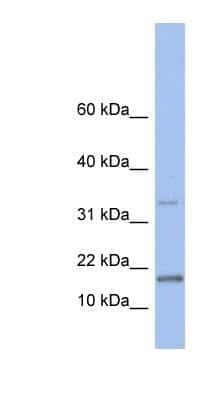 Western Blot: TCL1A Antibody [NBP1-54693] - Human Brain lysate, concentration 0.2-1 ug/ml.