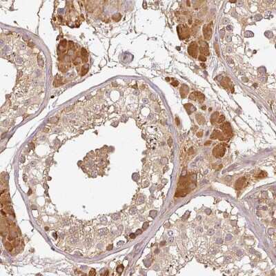 Immunohistochemistry: TCL1B Antibody [NBP2-47608] - Staining of human testis shows moderate cytoplasmic  positivity in cells in seminiferous ducts, Leydig cells were strongly stained.