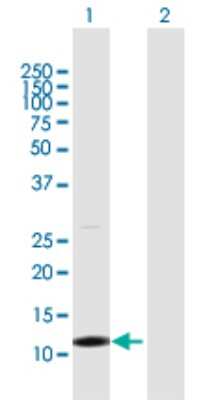 Western Blot: TCL1B Antibody [H00009623-D01P] - Analysis of TCL1B expression in transfected 293T cell line by TCL1B polyclonal antibody.Lane 1: TCL1B transfected lysate(14.90 KDa).Lane 2: Non-transfected lysate.