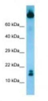 Western Blot: TCL1B Antibody [NBP1-98534] - MCF7 Cell Lysate 1.0ug/ml