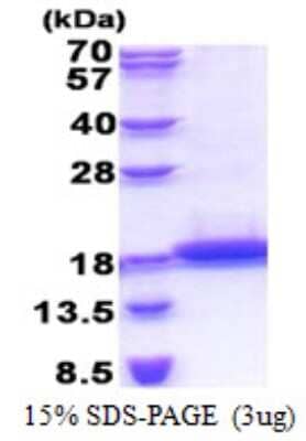 SDS-Page: TCL1B Protein [NBP2-22854]