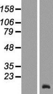 Western Blot TCL6 Overexpression Lysate