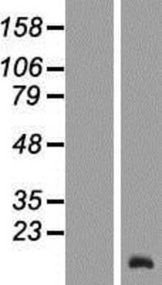 Western Blot: TCL6 Overexpression Lysate (Adult Normal) [NBP2-09849] Left-Empty vector transfected control cell lysate (HEK293 cell lysate); Right -Over-expression Lysate for TCL6.
