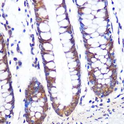 Immunohistochemistry-Paraffin: TCP1 alpha Antibody (3G9G8) [NBP3-16290] - Immunohistochemistry of paraffin-embedded human colon using TCP1 alpha Rabbit mAb (NBP3-16290) at dilution of 1:100 (40x lens).Perform microwave antigen retrieval with 10 mM PBS buffer pH 7.2 before commencing with IHC staining protocol.