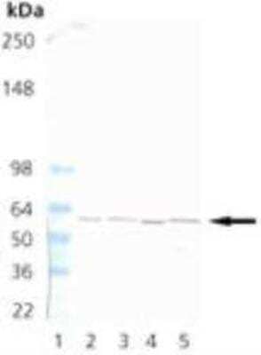 Western Blot TCP1 alpha Antibody (91a)