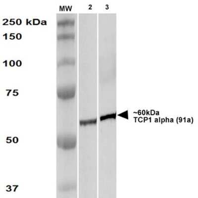 Western Blot: TCP1 alpha Antibody (91a) [NBP2-59347] - Western Blot analysis of Human A431 and HEK293 cell lysates showing detection of TCP1 alpha protein using Rat Anti-TCP1 alpha Monoclonal Antibody, Clone 91a (NBP2-59347). Primary Antibody: Rat Anti-TCP1 alpha Monoclonal Antibody (NBP2-59347) at 1:1000.