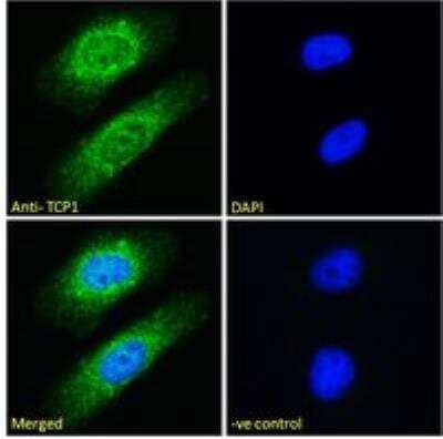 Immunocytochemistry/Immunofluorescence: TCP1 alpha Antibody [NB100-1400] - Analysis of paraformaldehyde fixed HeLa cells, permeabilized with 0.15% Triton. Primary incubation 1hr (10ug/ml) followed by Alexa Fluor 488 secondary antibody (2ug/ml), showing cytoplasmic and nuclear staining. The nuclear stain is DAPI (blue). Negative control: Unimmunized goat IgG (10ug/ml) followed by Alexa Fluor 488 secondary antibody (2ug/ml).