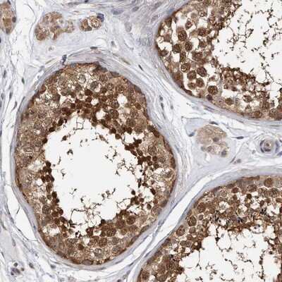 <b>Independent Antibodies Validation. </b>Immunohistochemistry-Paraffin: TCP1 alpha Antibody [NBP1-88149] - Staining of human testis shows strong nuclear and cytoplasmic positivity in cells in seminiferus ducts.