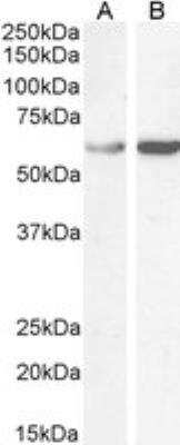 Western Blot TCP1 alpha Antibody