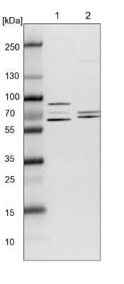 Western Blot: TCP1 alpha Antibody [NBP1-88148] - Lane 1: NIH-3T3 cell lysate (Mouse embryonic fibroblast cells). Lane 2: NBT-II cell lysate (Rat Wistar bladder tumor cells).