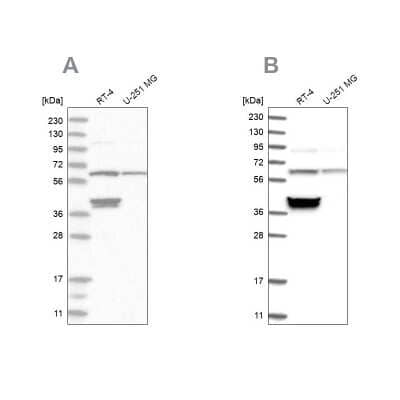 Western Blot: TCP1 alpha Antibody [NBP1-88148] - Analysis using Anti-TCP1 antibody NBP1-88148 (A) shows similar pattern to independent antibody NBP1-88149 (B).