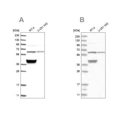 Western Blot: TCP1 alpha Antibody [NBP1-88149] - Analysis using Anti-TCP1 antibody NBP1-88149 (A) shows similar pattern to independent antibody NBP1-88148 (B).