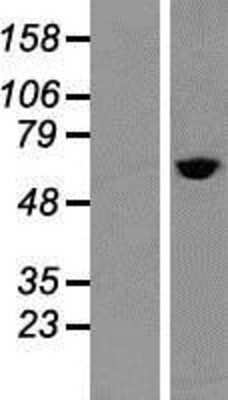 Western Blot: TCP1 alpha Overexpression Lysate (Adult Normal) [NBP2-06194] Left-Empty vector transfected control cell lysate (HEK293 cell lysate); Right -Over-expression Lysate for TCP1 alpha.