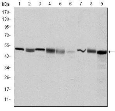 Western Blot: TCP1-beta Antibody (5B5F5) [NBP2-37561] - Western blot analysis using CCT2 mouse mAb against Hela (1), MCF-7 (2), Jurkat (3), T47D (4), K562 (5), A431 (6), NIH/3T3 (7), PC-12 (8) and Cos7 (9) cell lysate.