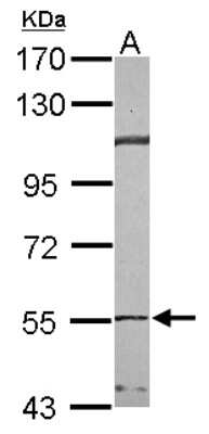 Western Blot: TCP1-beta Antibody [NBP2-20586] - Sample (30 ug of whole cell lysate) A: A549 7. 5% SDS PAGE gel, diluted at 1:1000.