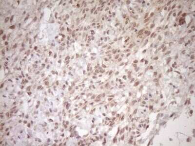 Immunohistochemistry TCP10 Antibody (OTI2C2)