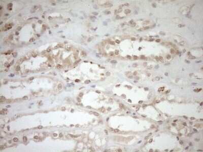 Immunohistochemistry: TCP10 Antibody (OTI2C2) - Azide and BSA Free [NBP2-74474] - Analysis of Human Kidney tissue. (Heat-induced epitope retrieval by 1mM EDTA in 10mM Tris buffer (pH8.5) at 120C for 3 min)