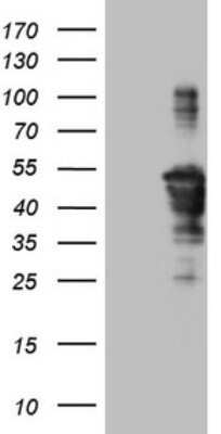 Western Blot: TCP10 Antibody (OTI2C2) - Azide and BSA Free [NBP2-74474] - Analysis of HEK293T cells were transfected with the pCMV6-ENTRY control (Left lane) or pCMV6-ENTRY TCP10.