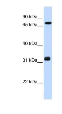 Western Blot: TCP10 Antibody [NBP1-55165] - Titration: 0.2-1 ug/ml, Positive Control: Hela cell lysate.