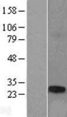 Western Blot: TCP10L Overexpression Lysate (Adult Normal) [NBL1-16788] Left-Empty vector transfected control cell lysate (HEK293 cell lysate); Right -Over-expression Lysate for TCP10L.