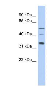 Western Blot: TCP11 Antibody [NBP1-56519] - DU145 cell lysate, concentration 0.2-1 ug/ml.